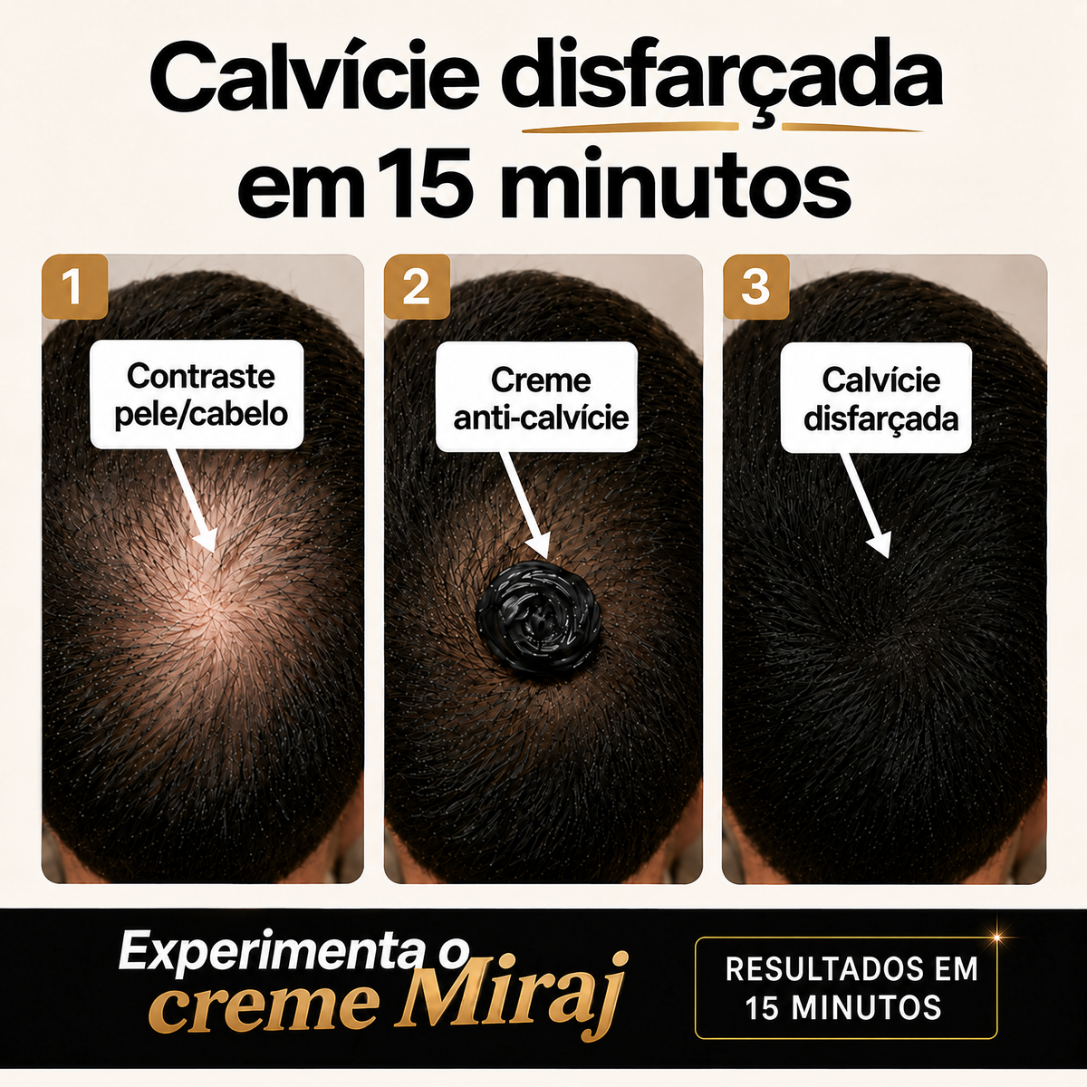 Calvície disfarçada em 15 minutos